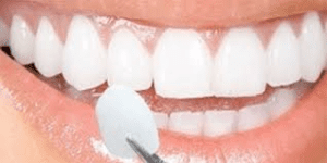 Amil Dental Aquidauana