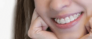 Amil Dental Boa Vista