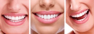 Amil Dental Ceara-mirim