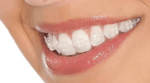 Amil Dental Caceres