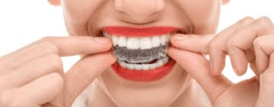 Amil Dental Diamantina