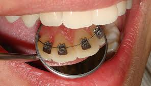 Amil Dental Parnamirim