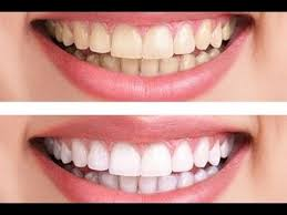 Amil Dental Patrocinio Muriae