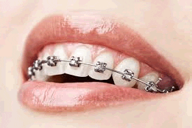 Amil Dental Sao Goncalo Sapucai