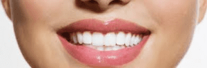 Amil Dental Viamao
